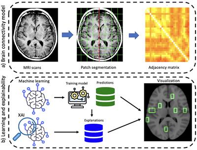 An eXplainability Artificial Intelligence approach to brain connectivity in Alzheimer's disease
